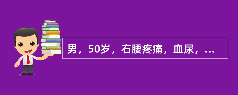 男，50岁，右腰疼痛，血尿，低热3个月。体格检查：贫血貌，腹部肥大，未扪及肿块，右精索静脉曲张Ⅲ度，左精索静脉未见曲张。血沉快。在影像学检查结果未出结果前，此患者的诊断可能是（　　）。