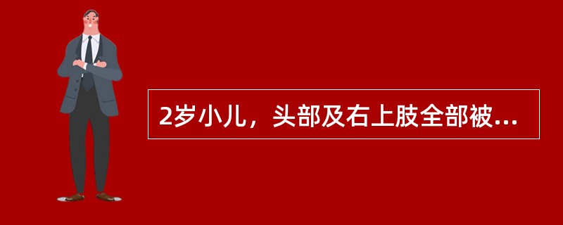 2岁小儿，头部及右上肢全部被开水烫伤，8小时入院。病儿入院时呈嗜睡状态，皮肤发花，心音低钝，脉搏细弱，伤面大部分表皮脱落，散在水泡。估计烧伤面积为（　　）。