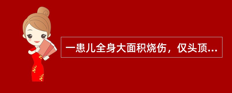 一患儿全身大面积烧伤，仅头顶及腰部约五掌面积未烧伤,则烧伤面积为（　　）。