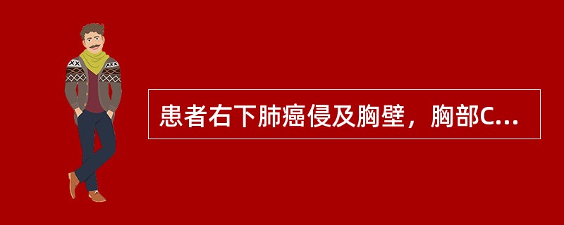 患者右下肺癌侵及胸壁，胸部CT示肺门、纵隔未见肿大淋巴结，未发现远处转移，该患者TNM分期属于