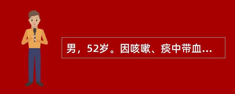 男，52岁。因咳嗽、痰中带血1个月入院。患者1个月前因受凉后出现咳嗽、咳痰症状，痰为白色泡沫痰，量较少。剧烈咳嗽后出现痰中带血，在当地医院给予抗感染及对症治疗，痰中带血症状消失，但咳嗽症状改善不明显。