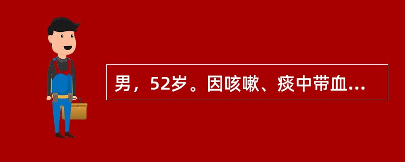 男，52岁。因咳嗽、痰中带血1个月入院。患者1个月前因受凉后出现咳嗽、咳痰症状，痰为白色泡沫痰，量较少。剧烈咳嗽后出现痰中带血，在当地医院给予抗感染及对症治疗，痰中带血症状消失，但咳嗽症状改善不明显。