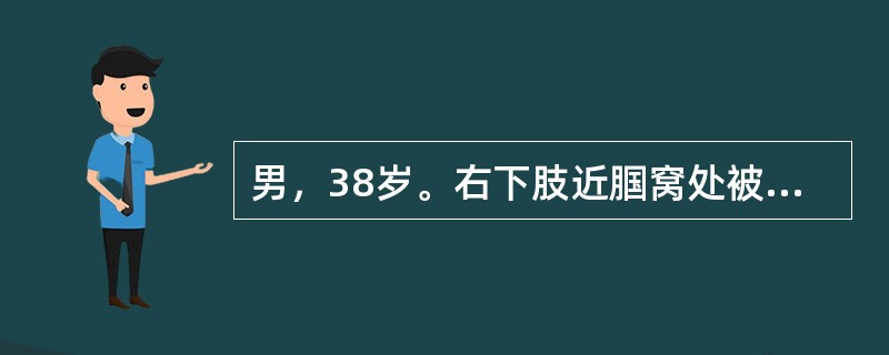 男，38岁。右下肢近腘窝处被刀刺伤后出现搏动性肿块，逐渐增大伴右下肢麻木，查右下肢苍白，胭窝部搏动性肿块大小为5cm×4cm，附近有收缩期杂音，诊断为