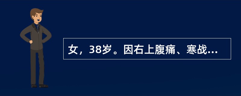 女，38岁。因右上腹痛、寒战高热，呕血约200ml。查体：皮肤巩膜黄染，肝肋下1cm,触痛明显。Murphy征（+），最可能的诊断是