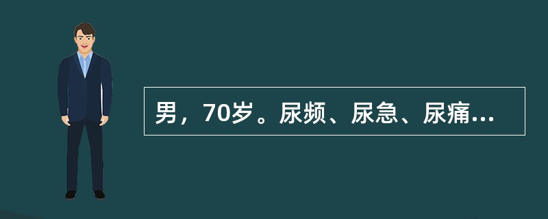 男，70岁。尿频、尿急、尿痛，伴血尿，一般抗生素治疗无效。尿检：白细胞30～40个，红细胞20～30个/HP。有肺结核病史。检查时最有可能的阳性发现包括（　　）。