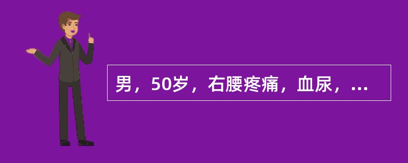 男，50岁，右腰疼痛，血尿，低热3个月。体格检查：贫血貌，腹部肥大，未扪及肿块，右精索静脉曲张Ⅲ度，左精索静脉未见曲张。血沉快。在影像学检查结果未出结果前，此患者的诊断可能是（　　）。