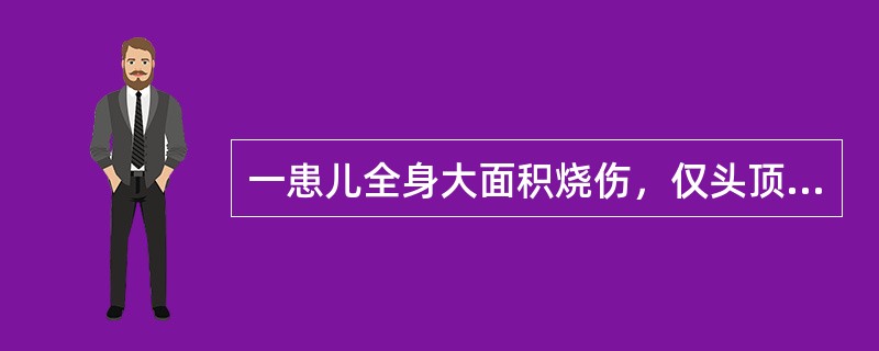 一患儿全身大面积烧伤，仅头顶及腰部约五掌面积未烧伤，则烧伤面积为（　　）。