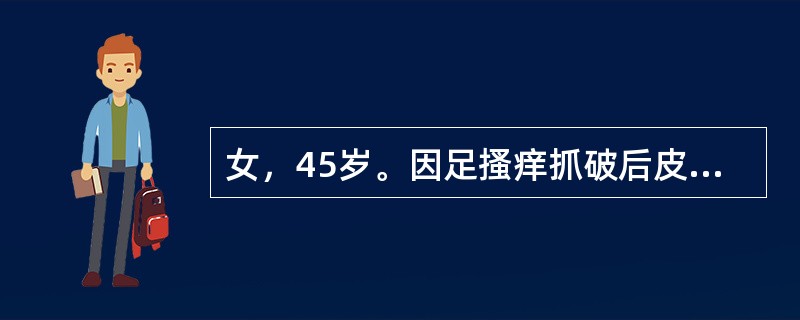 女，45岁。因足搔痒抓破后皮肤破溃，继而于小腿及大腿中下段出现一红线，压痛，患肢轻度肿胀，诊断考虑为（　　）。