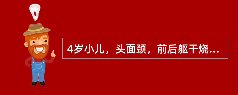 4岁小儿，头面颈，前后躯干烧伤，面积为（　　）。