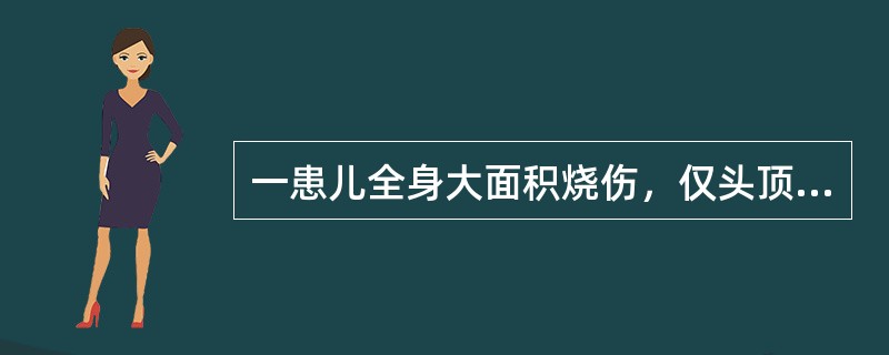 一患儿全身大面积烧伤，仅头顶及腰部约五掌面积未烧伤，则烧伤面积为（　　）。