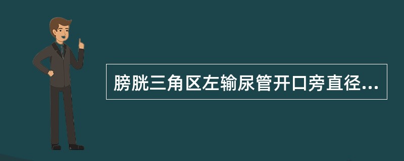 膀胱三角区左输尿管开口旁直径2cm有蒂肿块，静脉尿路造影：膀胱左侧壁充盈缺损，左输尿管中下段扩张（　　）。