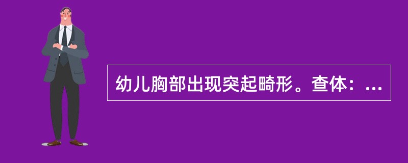 幼儿胸部出现突起畸形。查体：胸骨体前凸，肋软骨及肋骨凹陷。可能诊断为（　　）。