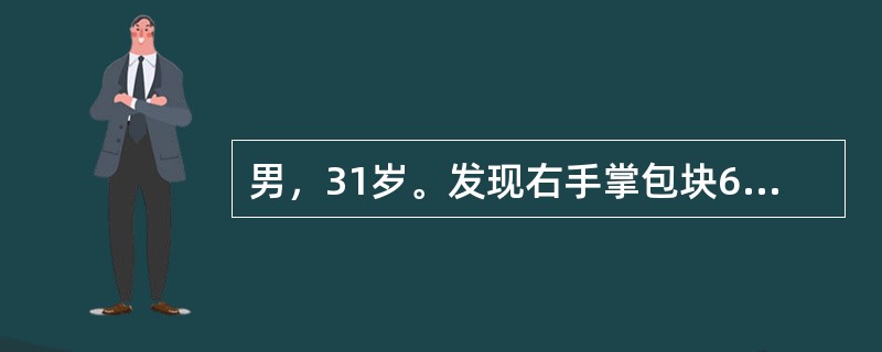 男，31岁。发现右手掌包块6个月。查体：右手掌中部有一直径为5cm卵圆形包块，突出于表皮，与皮肤粘连，质硬，可活动，有轻压痛。最可能的诊断是（　　）。