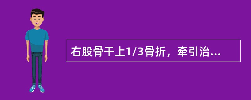 右股骨干上1/3骨折，牵引治疗时最好体位是