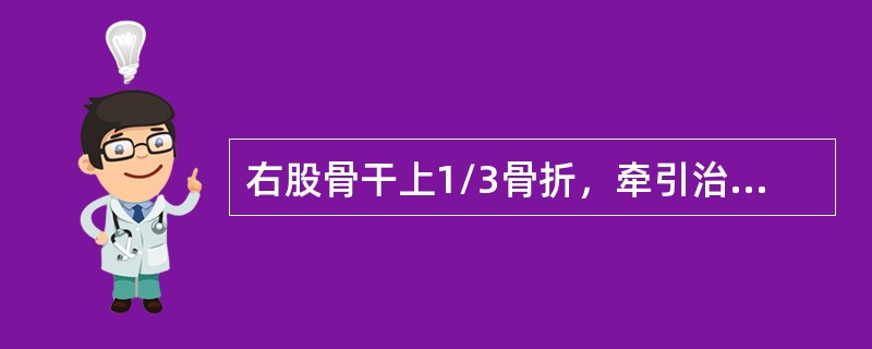 右股骨干上1/3骨折，牵引治疗时最好体位是