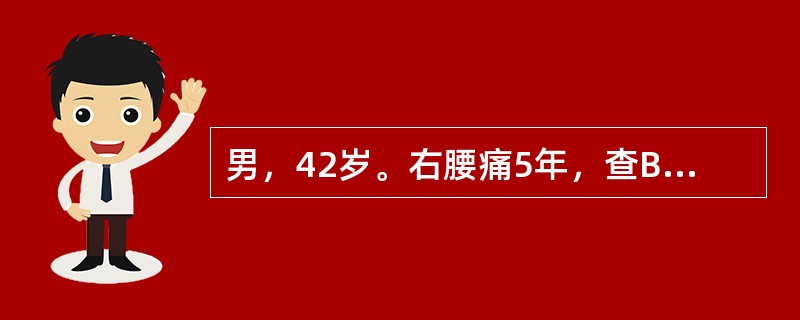 男，42岁。右腰痛5年，查B超：右肾中度积水，腹部平片可见右侧输尿管中段结石2cm，静脉肾盂造影：左肾显示正常，右肾盏显示扩张，肾盂未显示，行右肾穿刺造影：右肾中度积水，输尿管上段扩张2cm，结石下输