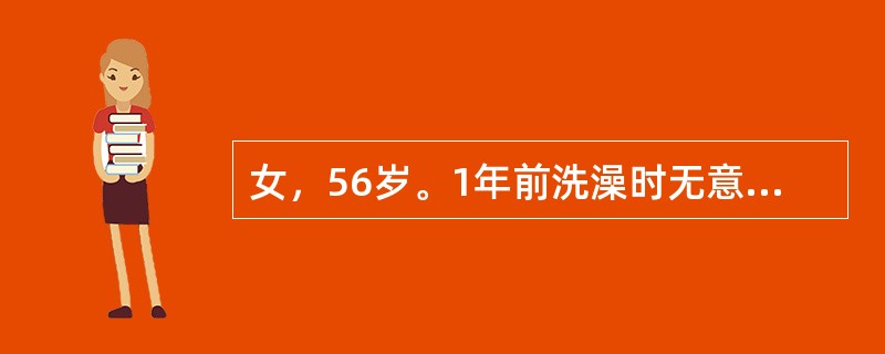 女，56岁。1年前洗澡时无意中扪及右侧乳房一肿块，无痛，查体：在右乳外上象限见局限性皮肤凹陷，该部位能扪及3cm×2cm大小肿块。此处皮肤凹陷最可能的原因是（　　）。