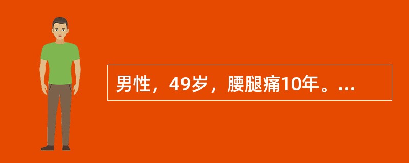 男性，49岁，腰腿痛10年。查体：腰5～骶l间压痛，并放射至小腿外侧，左侧直腿抬高试验阳性，加强试验阳性。最可能的诊断是（　　）。