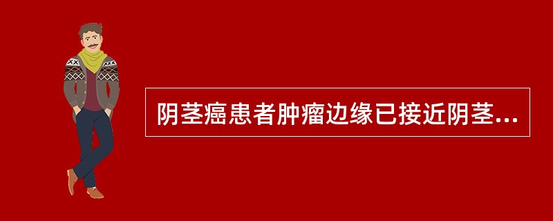 阴茎癌患者肿瘤边缘已接近阴茎基部，左侧腹股沟淋巴结活检有转移，应如何处理（　　）。