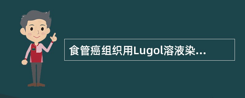 食管癌组织用Lugol溶液染色呈（　　）。