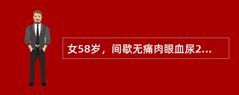 女58岁，间歇无痛肉眼血尿2月余，查体未发现异常。肾脏B超提示右肾中下极4.5cm低回声肿物，向肾外侧突出。该患者在做静脉肾盂造影时最可能出现的异常情况是（　　）。