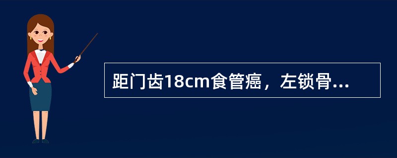 距门齿18cm食管癌，左锁骨上可触及一直径5cm质硬淋巴结，其分期至少应为（　　）。