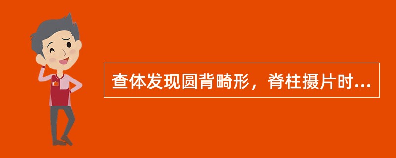 查体发现圆背畸形，脊柱摄片时发现竹节样改变，骶髂关节融合，应怀疑（　　）。