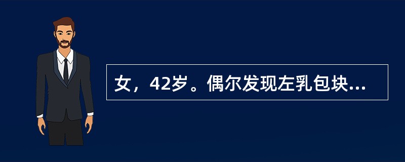 女，42岁。偶尔发现左乳包块半个月余，无自觉症状，未见增大。检查，左乳头外上象限有一约2.0cm×5cm×5cm包块，质地硬、无压痛。与皮肤有轻度粘连。左腋下可扪及直径1cm大小结节。该病例最可能是下