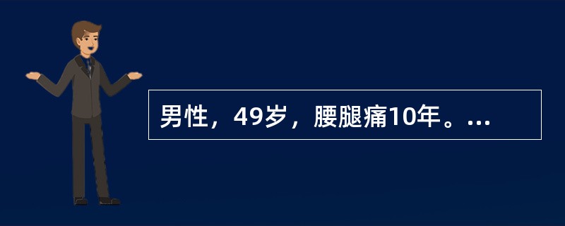 男性，49岁，腰腿痛10年。查体：腰5～骶l间压痛，并放射至小腿外侧，左侧直腿抬高试验阳性，加强试验阳性。最可能的诊断是（　　）。