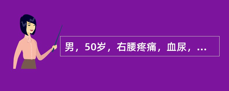男，50岁，右腰疼痛，血尿，低热3个月。体格检查：贫血貌，腹部肥大，未扪及肿块，右精索静脉曲张Ⅲ度，左精索静脉未见曲张。血沉快。在影像学检查结果未出结果前，此患者的诊断可能是（　　）。