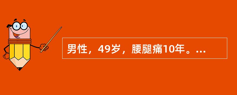 男性，49岁，腰腿痛10年。查体：腰5～骶l间压痛，并放射至小腿外侧，左侧直腿抬高试验阳性，加强试验阳性。最可能的诊断是（　　）。