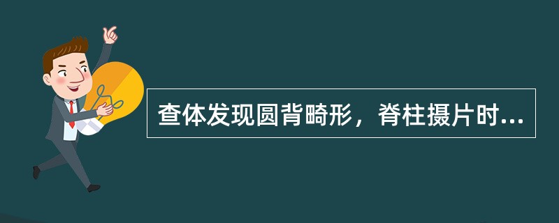 查体发现圆背畸形，脊柱摄片时发现竹节样改变，骶髂关节融合，应怀疑（　　）。