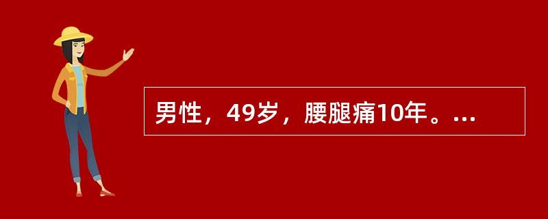 男性，49岁，腰腿痛10年。查体：腰5～骶l间压痛，并放射至小腿外侧，左侧直腿抬高试验阳性，加强试验阳性。最可能的诊断是（　　）。