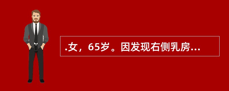 .女，65岁。因发现右侧乳房近乳头处包块半年来院就诊，既往体健。查体：右侧乳腺外上象限近乳头处可触及约3cm×5cm质硬肿物，无压痛，边界尚清，右侧腋窝可及肿大淋巴结但尚可推动，左侧腋窝未触及明显肿大