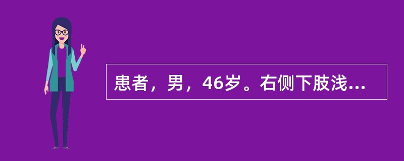 患者，男，46岁。右侧下肢浅表静脉曲张5年，长时间站立后小腿和足部出现胀痛，上述症状逐渐加重；右侧足靴区皮肤增厚粗糙，伴色素沉着。顺行性静脉造影显示大隐静脉显著扩张，深静脉通畅、呈直筒状。该患者接受逆