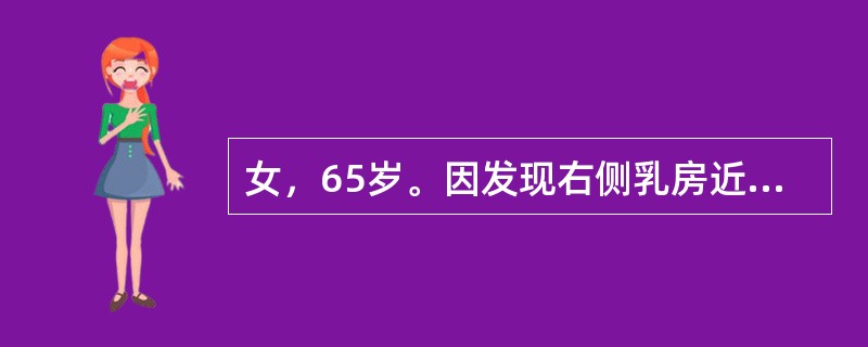 女，65岁。因发现右侧乳房近乳头处包块半年来院就诊，既往体健。查体：右侧乳腺外上象限近乳头处可触及约3cm×5cm质硬肿物，无压痛，边界尚清，右侧腋窝可及肿大淋巴结但尚可推动，左侧腋窝未触及明显肿大淋