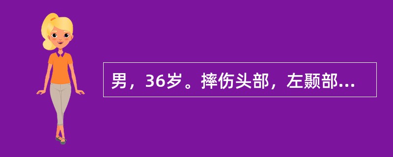 男，36岁。摔伤头部，左颞部着力，昏迷，左瞳孔散大，X线摄片示左颞骨折线跨过脑膜中动脉。最可能的诊断是（　　）。