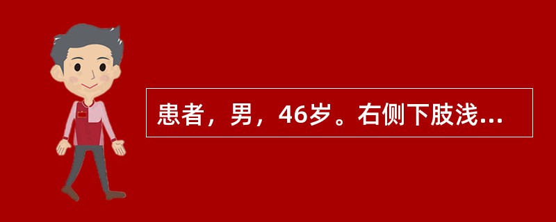 患者，男，46岁。右侧下肢浅表静脉曲张5年，长时间站立后小腿和足部出现胀痛，上述症状逐渐加重；右侧足靴区皮肤增厚粗糙，伴色素沉着。顺行性静脉造影显示大隐静脉显著扩张，深静脉通畅、呈直筒状。该患者接受逆