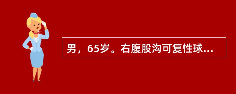 男，65岁。右腹股沟可复性球形包块3年。查体：站立时右耻骨结节外上方可见一球形包块，未进入阴囊，平卧时可自行回纳，压迫腹股沟韧带中点上方2cm处站立时包块复出，应诊断是（　　）。