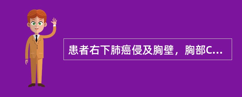 患者右下肺癌侵及胸壁，胸部CT示肺门、纵隔未见肿大淋巴结，未发现远处转移，该患者TNM分期属于（　　）。