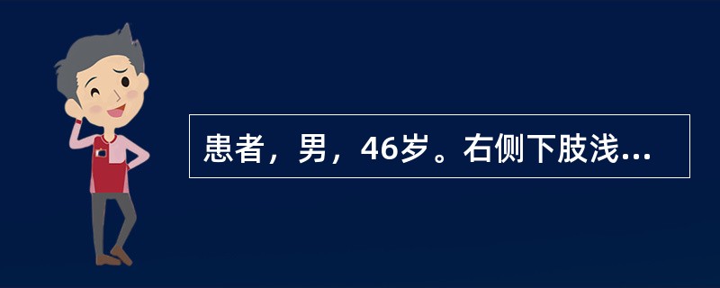 患者，男，46岁。右侧下肢浅表静脉曲张5年，长时间站立后小腿和足部出现胀痛，上述症状逐渐加重；右侧足靴区皮肤增厚粗糙，伴色素沉着。顺行性静脉造影显示大隐静脉显著扩张，深静脉通畅、呈直筒状。该患者最可能