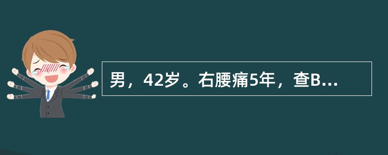 男，42岁。右腰痛5年，查B超：右肾中度积水，腹部平片可见右侧输尿管中段结石2cm，静脉肾盂造影：左肾显示正常，右肾盏显示扩张，肾盂未显示，行右肾穿刺造影：右肾中度积水，输尿管上段扩张2cm，结石下输