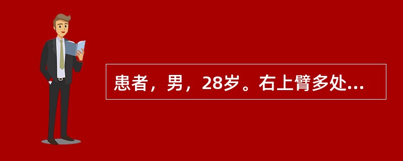 患者，男，28岁。右上臂多处刀砍伤，右肘关节活动可，右上臂拇、示、中指不能屈曲，拇指不能外展和对掌，桡侧三个半手指掌侧均无感觉。该患者可能损伤（　　）。