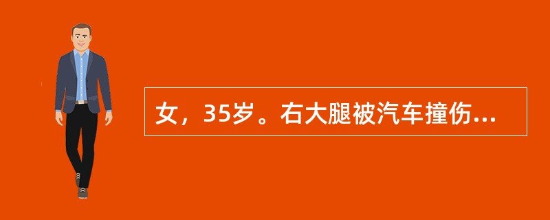 女，35岁。右大腿被汽车撞伤24小时，伤后右大腿中段明显肿胀、压痛，向外成角畸形，皮温高于对侧。体温38℃，白细胞正常，最可能是下列哪项诊断？（　　）