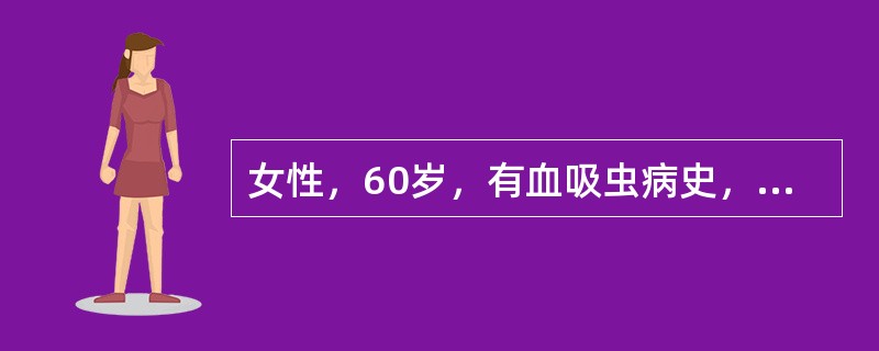 女性，60岁，有血吸虫病史，近半年来大便出血，鲜红色，肛门指诊：距齿状线6cm处可扪及2.5cm高低不平肿块，指套染血（　　）。