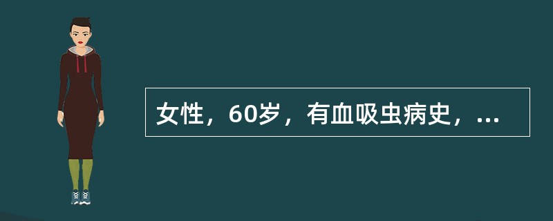 女性，60岁，有血吸虫病史，近半年来大便出血，鲜红色，肛门指诊：距齿状线6cm处可扪及2.5cm高低不平肿块，指套染血（　　）。