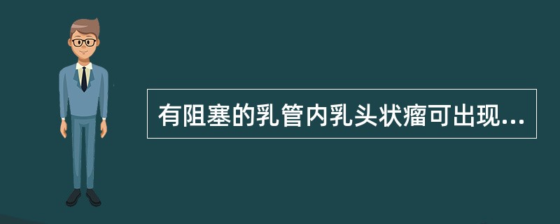 有阻塞的乳管内乳头状瘤可出现（　　）。