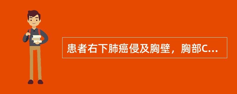 患者右下肺癌侵及胸壁，胸部CT示肺门、纵隔未见肿大淋巴结，未发现远处转移，该患者TNM分期属于（　　）。