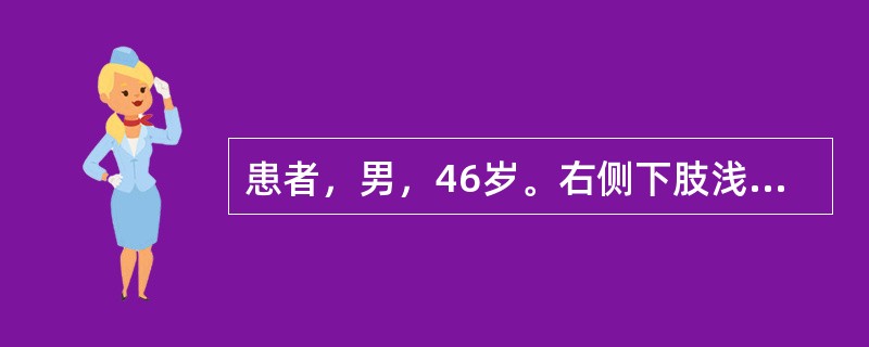 患者，男，46岁。右侧下肢浅表静脉曲张5年，长时间站立后小腿和足部出现胀痛，上述症状逐渐加重；右侧足靴区皮肤增厚粗糙，伴色素沉着。顺行性静脉造影显示大隐静脉显著扩张，深静脉通畅、呈直筒状。该患者接受逆