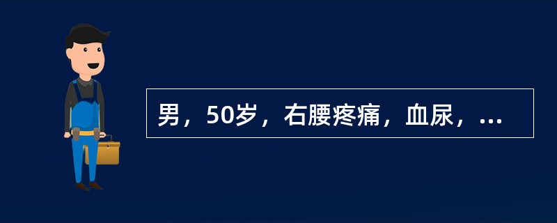 男，50岁，右腰疼痛，血尿，低热3个月。体格检查：贫血貌，腹部肥大，未扪及肿块，右精索静脉曲张Ⅲ度，左精索静脉未见曲张。血沉快。在影像学检查结果未出结果前，此患者的诊断可能是（　　）。
